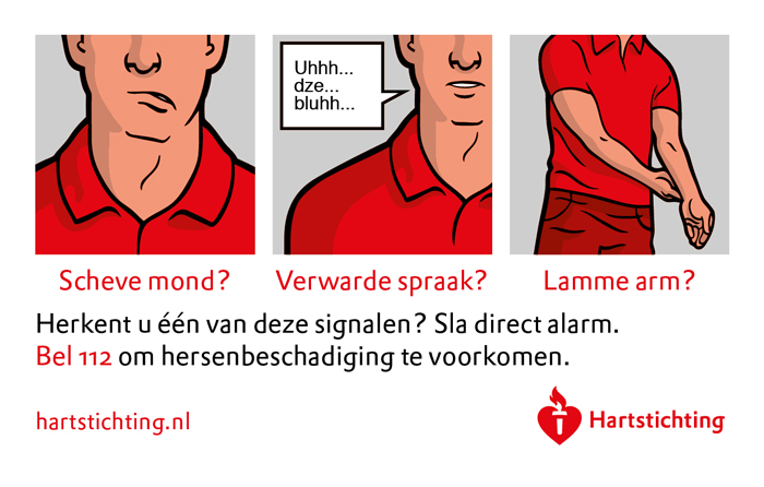 signalen_beroerte.jpg
