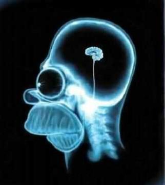 smallbrain.jpg